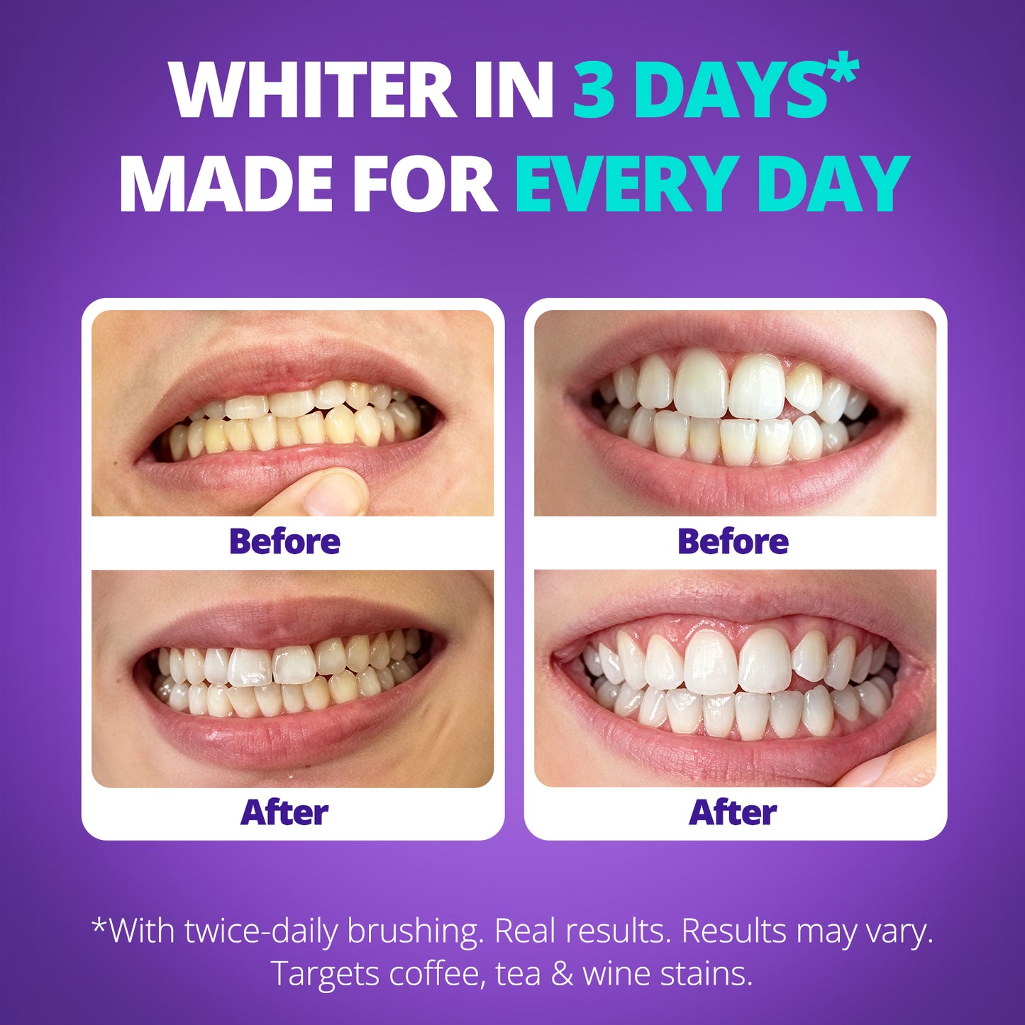 Ultra Whitening Toothpaste