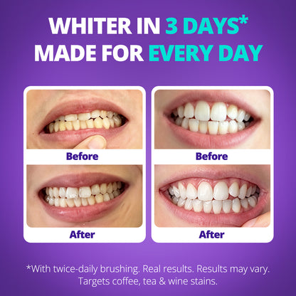 Ultra Whitening Toothpaste