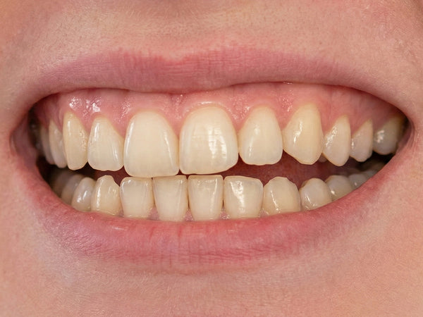 Before - Sarah M.