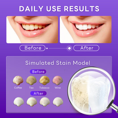 Ultra Whitening Toothpaste