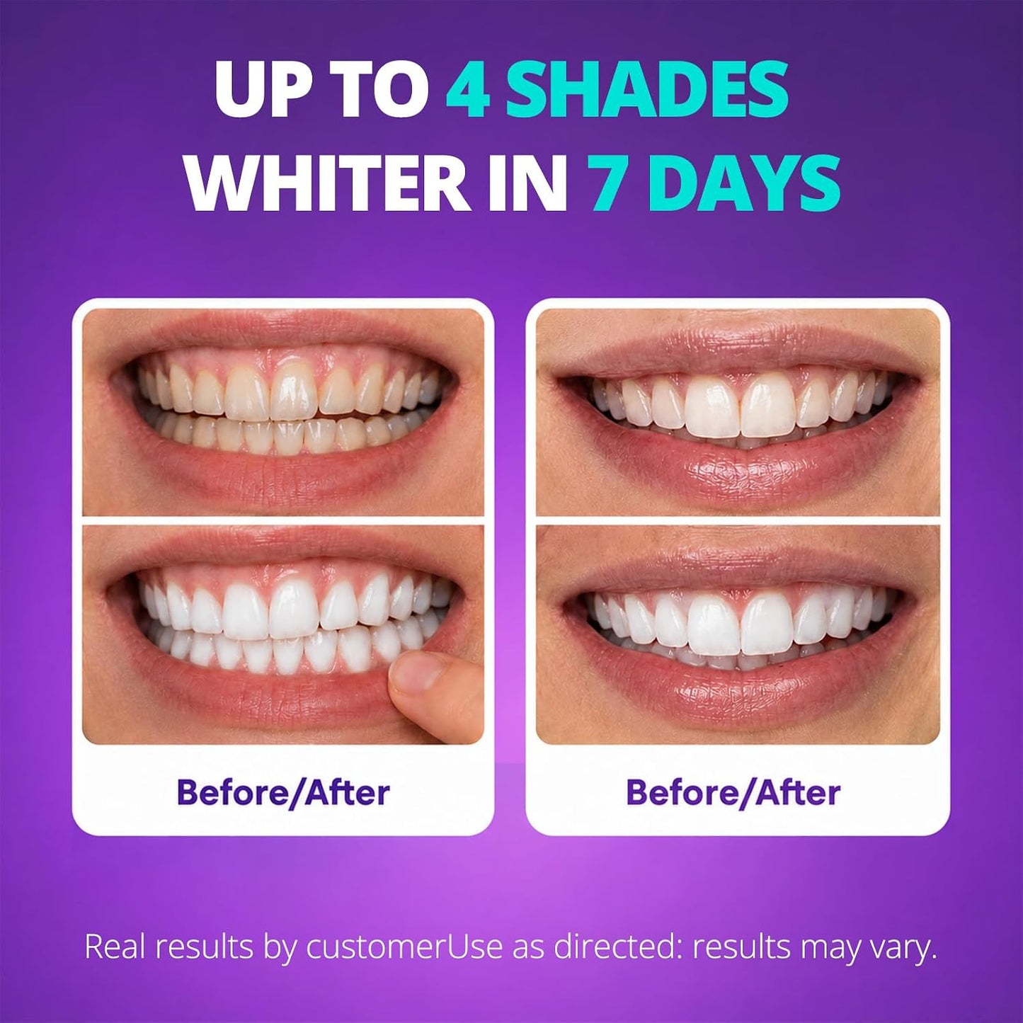 Purple Whitening Strips